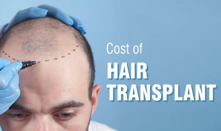 Hair Transplant Cost Guide