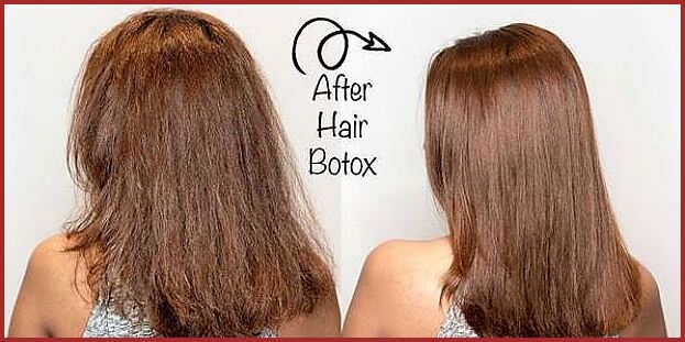 Who might use Botox for hair?